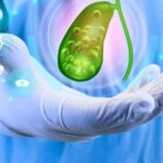 Especialista: atender a tiempo la litiasis vesicular evita complicaciones mortales